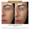 DermEden C-Powder Flash veido serumas su 20 % gryno vitamino C