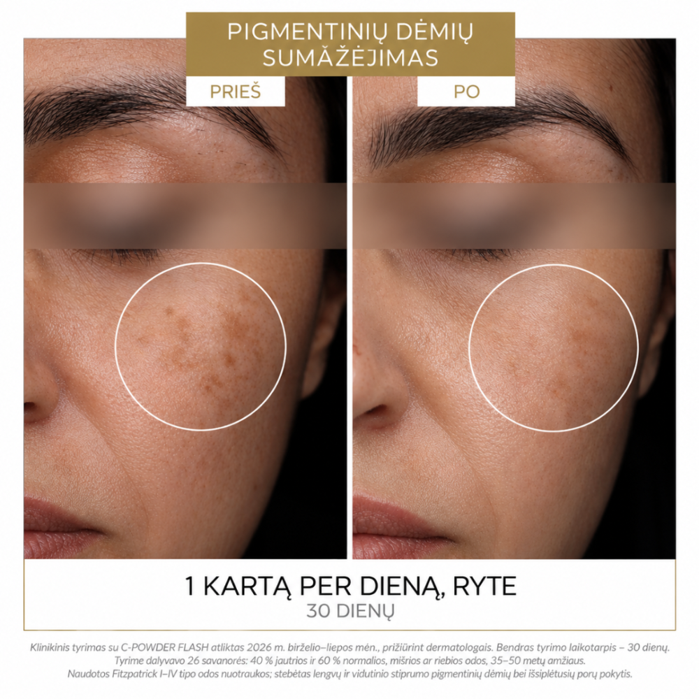 DermEden C-Powder Flash veido serumas su 20 % gryno vitamino C