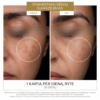 DermEden C-Powder Flash veido serumas su 20 % gryno vitamino C